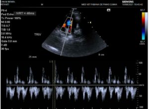 ecocardiograma